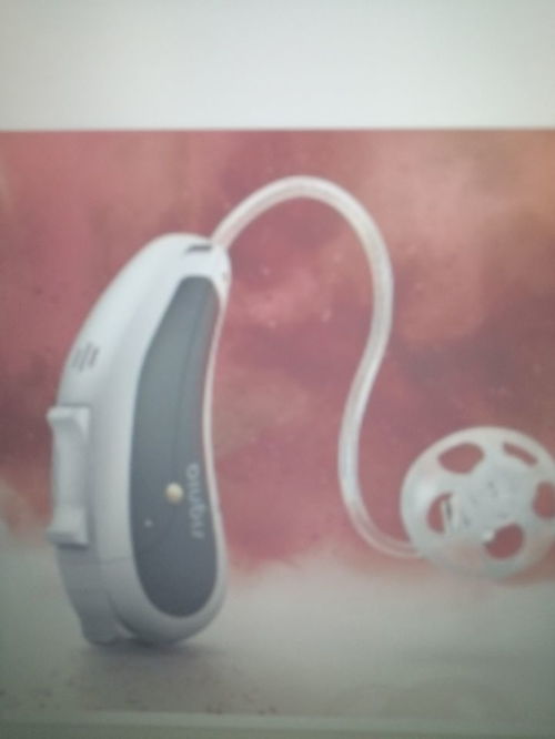 如何消除助听器的“耳闷”现象？实用方法与原因解析